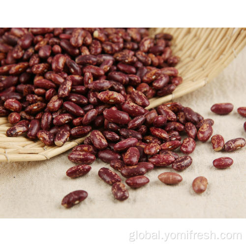 Kidney Beans Breakfast Kidney Beans Health Benefits Supplier